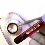 New Norovirus Strain Overwhelms US Immunity