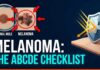 Melanoma: How to Spot Silent Warning Signs Skin Cancer Warning Signs: How to Spot Melanoma Early | Clinical Protocol