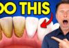 Teeth Whitening at Home – Two-Ingredient Hack The #1 BEST Remedy for Dental Plaque (TARTAR)