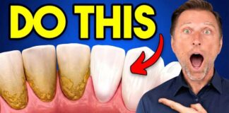 The #1 BEST Remedy for Dental Plaque (TARTAR)