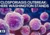 Where Washington stands as the cyclosporiasis outbreak surges | FOX 13 Seattle