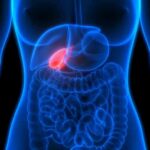 Why Gallstones Usually Cause Such EXCRUCIATING Pain Human torso anatomy highlighting the gallbladder